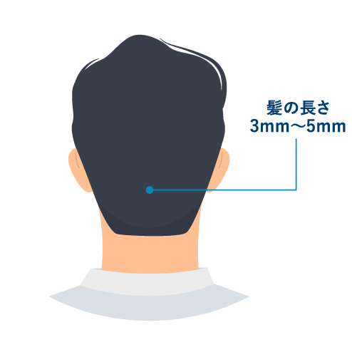 ジェネリック医薬品