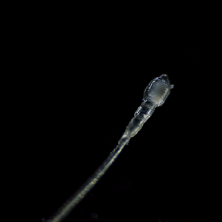 毛根につく白い塊とは？毛根に皮脂が付着する原因と毛根鞘との違いやケア方法について解説