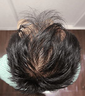 京都駅前院の症例写真 治療前